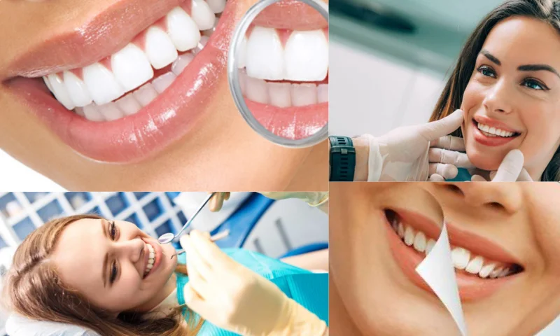 İstanbul'da Diş Kliniği - كلينك اسنان في اسطنبول Nasıl Seçilir?