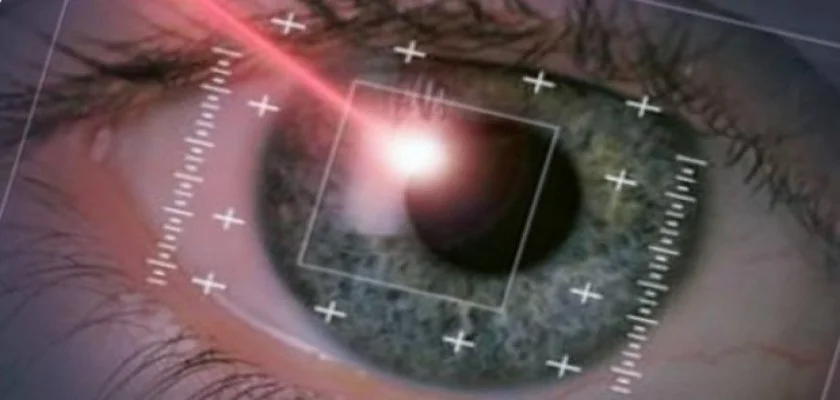 Lazerle Göz Ameliyatı Nasıl Yapılır?