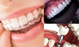 En İyi Diş Hekimi Nasıl Anlaşılır?