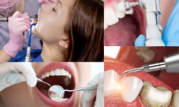 Diş Temizliği: Sağlıklı Bir Gülümseme İçin Önemli Adımlar