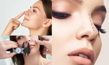 Preservation Rhinoplasty ile Klasik Burun Estetiği Arasındaki Fark Nedir?