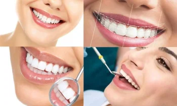 Kozmetik Diş Hekimliği - Cosmetic Dentistry Nedir?
